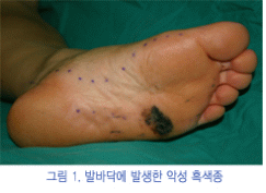 where are a dogs lympnodes located at