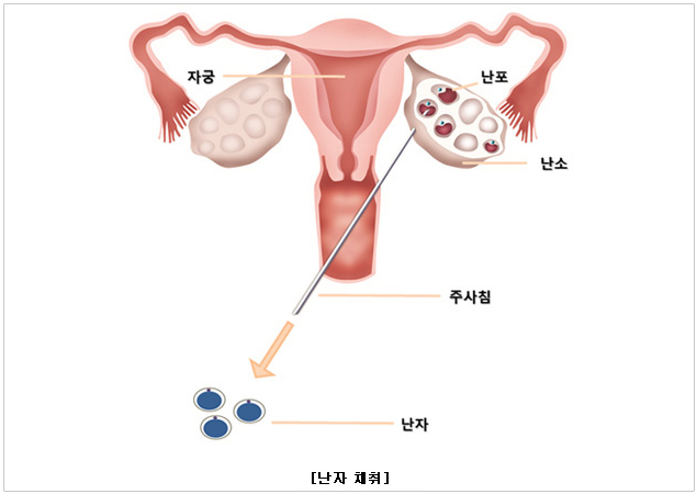 불임시험관 난자 채취, 난자질 개선, 임신 준비, 착상에 도움이 되는 포도즙 추천(내돈내산) 왕포농원 장단점 1년 후 리뷰